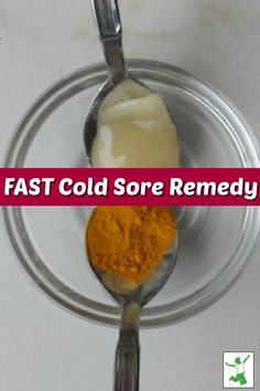 Cold sores or fever blisters, most people get them. There are some wonderful natural remedies to help with the cold sores. Come find out about three fast cold sore remedies that you could be using today! #coldsores #coldsoreremedies #coldsoreremedy #feverblisters #feverblisterremedy #feverblisterremedies #naturalremedies #mrsjonescreationstation Cold Sore Remedy Fast, Heal Cold Sores Fast, Cold Sore Remedies, Fever Blister Remedy, Baby Cold Remedies, How To Heal Blisters, Home Remedies For Cold, Home Remedies For Fever, Cold Sore Relief