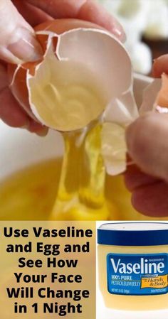 Use Vaseline and Egg and See How Your Face Will Change in 1 Night. It removed Wrinkles, Dark Spots, Pigmentation and get rid of uneven skin tone, hyperpigmen... Vaseline And Egg Yolk Face Mask, Egg Yolk Face Mask, Vaseline Uses For Face, Vaseline For Face, Egg White Mask, Egg Face Mask, Face Wrinkles Remedies, Egg White Face Mask, Egg Mask