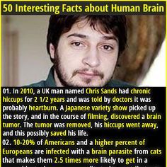 a man is looking at the camera and has an interesting fact about human brain damage