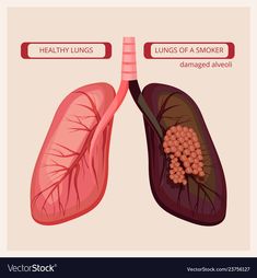 the lungs and broccoli are labeled in this diagram