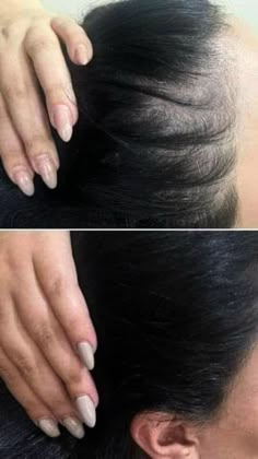 Nada de desespero! Com o produto certo, seu cabelo vai parar de se despedir de você. Vem conhecer a solução que vai te fazer esquecer da queda. Clica aí e descubra! Prp Hair, Hair Facts, Hair Motivation, Graduation Picture, Brunette Woman, Short Wavy Hair, Hair Maintenance, Grow Hair, Picture Poses