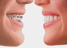 Dentist Invisalign Pediatric Dental, Dental Bridge, Dental Crowns, Dental Surgery, Dental Insurance