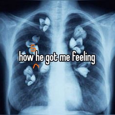 the words how he got me feeling are in front of an x - ray image