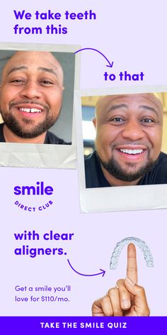 two men smiling and pointing at the same person's teeth, with text that reads smile perfect club with clear aligners get a smile for $ 69 / mo