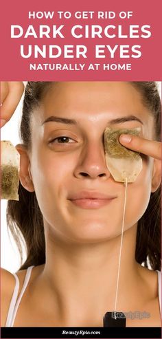 Eye Circle Remedies, Dark Spots Under Eyes, Dark Undereyes, Dark Circles Around Eyes, Dark Circle Remedies, Dark Eye Circles, Green Tea Benefits