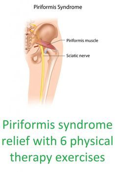 an image of a diagram of the hip and its surrounding area, with text explaining how it works