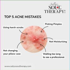 Struggling with acne due to genetics? Don't let it hold you back! Discover effective tips to overcome acne-prone skin and avoid common mistakes for clearer, healthier skin. Say goodbye to breakouts and hello to confidence! 💪
#AcneSolutions #ClearSkinTips #SkincareTips #AcneProneSkin #HealthySkin #ClearSkinJourney #AcneTreatment #SkincareMistakes #GeneticAcne #SallysSoulTherapy
 (Acne Solutions, Clear Skin Tips, Skincare Tips, Acne Prone Skin, Healthy Skin, Clear Skin Journey, Acne Treatment, Skincare Mistakes, Genetic Acne, Sallys Soul Therapy) Rash On Hands, Skin Journey, Skincare Mistakes, Cystic Acne Remedies, Acne Tips, Herbal Skincare, Breaking The Cycle, Soul Therapy, Forehead Acne