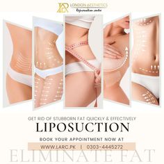 Plastic Surgery Ads, Loss Images, Ads Inspiration, B12 Injections, Beauty Redefined, Clear Healthy Skin, Tøp Aesthetic, Shape Pictures, Aesthetic Clinic