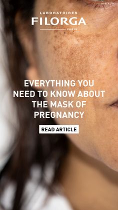 The mask of pregnancy: FILORGA explains everything you need to know about melasma. Liver Spot, Basement Membrane, Layers Of The Epidermis, Skin Blemishes, The Mask, Aging Skin Care, Facial Skin, Aging Skin, Pregnant Women