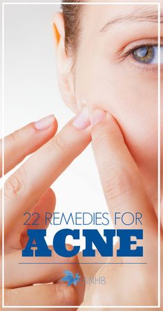 22 Natural Remedies for Acne. Natural Remedies For Acne, Remedies For Acne, Skincare Diy, Natural Acne, Home Remedies For Acne, Acne Problem, Cystic Acne