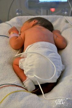 a baby in a diaper is hooked up to an iv and has wires attached to it