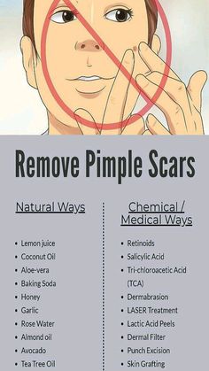 Pimple Scar Removal, Tea Tree Oil Skin, Pimple Scars, Skin Grafting, Clear Healthy Skin, Basic Skin Care Routine, How To Remove Pimples, Perfect Skin Care Routine, Healthy Skin Tips