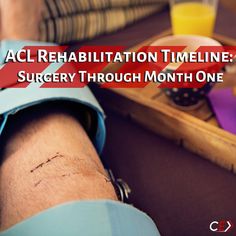 ACL Rehabilitation Timeline: Surgery Through Month One - Competitive Edge Acl Pt Exercises, Acl Recovery Exercises Workouts, Acl Prehab Exercises, Acl Recovery Quotes, Torn Acl Exercises, Post Acl Surgery