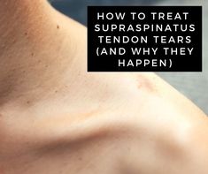 Supraspinatus Tendon Tear, Rotator Cuff Rehab, Supraspinatus Muscle, Shoulder Range Of Motion, Rotator Cuff Tear, Shoulder Impingement, Rotator Cuff Injury, Natural Remedies For Migraines, Ligament Tear