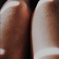 a close up view of someone's legs with brown spots on them