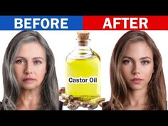 Herbal Vitamins, Caster Oil, Natural Hair Regrowth, Healing Techniques, Food Health Benefits, Natural Face Skin Care, Hair Remedies For Growth