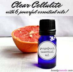 Lumpy dimpled and orange-peel textured skin can be reduced! How? Using essential oils of course! Here are 6 of the best essential oils for cellulite. Essential Oils For Varicose Veins, Work Recipes, Orange Peel Texture, Textured Skin, Natural Beauty Treatments, Essential Oils For Skin