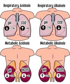 the different stages of acidatosis