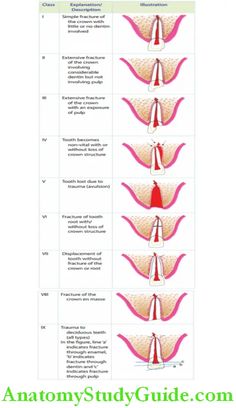 Dental Traumatology An Overview Introduction Dental traumatology requires more attention and profound discussion in paediatric dentistry as dental and orofacial trauma is being encountered commonly, especially in children. An injury to teeth, oral soft tissues and associated hard tissues has significant short-term and long-term consequences. A fracture of a tooth causes short-term consequences whereas a […] Hairline Fracture, Facial Bones, Toddler Fall, Jaw Bone, Medical History, Plastic Surgeon