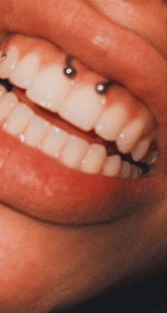 a woman's smile with braces and piercings on her teeth is shown