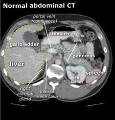 an mri scan shows the location of normal abnormal ct