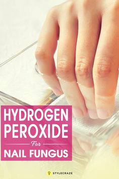 How To Use Hydrogen Peroxide For Nail Fungus – A Step By Step Guide Peroxide Uses, Fingernail Fungus, Toenail Fungus Remedies, Nail Fungus Remedy, Nail Infection, Fungal Nail, Ingrown Toe Nail, Toenail Fungus, Fungal Infection