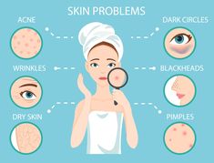 Skin Icon, Natural Acne, Dark Circles Under Eyes, Skin Issues, Skin Tips, Facial Masks, Diy Face Mask