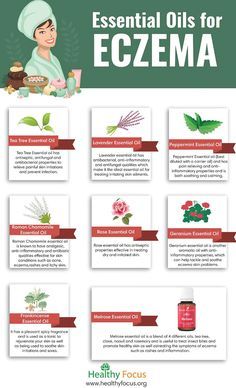 essential oils for eczema infographic Oil Remedies, Young Living Oils, Tea Tree Essential Oil, Best Essential Oils, Skin Care Remedies, Essential Oil Uses, Peppermint Essential Oil, Doterra Essential Oils, Essential Oil Recipes