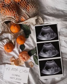 an oranges and other fruit on a bed next to a bag with a sign