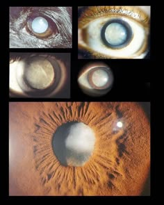 four different pictures of an eye with the iris opened and showing light coming through it