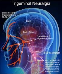 an image of the brain with labels on it