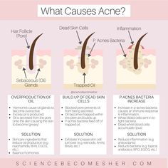 What Causes Acne, Blind Pimple, Forehead Acne, Pimples Under The Skin, Skin Advice, Skin Science, Oily Skin Care, How To Treat Acne