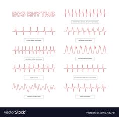 Conceptual Pictures, Normal Ecg, Medical Infographic, Medical Diagnosis, Vet Medicine, Heart Vector, Heart Beat, Paramedic, Cheat Sheet