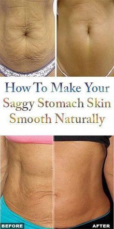 Tighten Stomach Skin, Tighten Stomach, Skin Firming Lotion, Skin Tightening Stomach, Skin Bumps, Saggy Skin, Health Skin Care