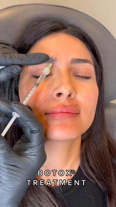 Lip Flip Botox Injection Sites, Botox Video, Botox Day, Homemade Face Mask