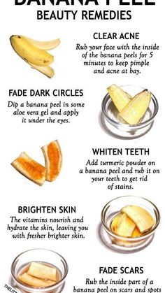 Banana Peel Uses, Banana Peels, Natural Skin Care Remedies, Resep Diet, Brown Spots Removal, Banana Peel, Baking Soda Shampoo, Makijaż Smokey Eye, Beauty Remedies