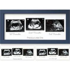 an x - ray shows the different stages of breasting and tummy art, framed in dark blue wood