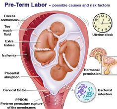 diagram of the pre - term labor and its functions in human body, including utensils