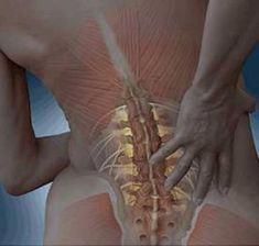 Lumbar spinal stenosis, or narrowing of your spinal canals, is the most common type of spinal stenosis. Learn the different symptoms, causes, & treatment options. Stenosis Of The Spine, Stenosis Exercises, Sciatic Nerve Relief, Spine Problems, Bulging Disc, Degenerative Disease, Lower Back Pain Exercises, Back Pain Remedies, Spine Health