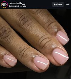 Mani Pedi Set Ideas, Nude Short Acrylic Nails, Cute Overlay Nails, Gel Overlay Nails, Nails 23, Nails Pedicure, Overlay Nails, Pedicure Designs Toenails, Brown Acrylic Nails