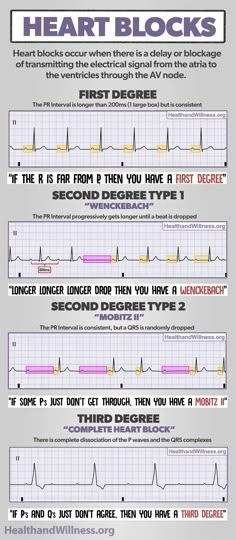 an info sheet describing the different types of blood pressures and how to use them