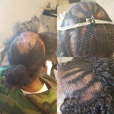 Braids For Alopecia, Crochet On Alopecia, Alopecia Bandana, Frontal Fibrosing Alopecia Hair Pieces, Curly Crochet Braids, Hair Growth Formula, Alopecia Hairstyles, Traction Alopecia, Crochet Faux Locs