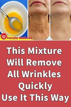 Just apply this remedy, you can Get Rid Of Neck Wrinkles and have healthier skin. It will help smooth, firm, and soften skin as well as to Get Rid Of Neck Wr... Neck Wrinkles Remedies, Natural Wrinkle Remedies, Neck Wrinkles, Face Wrinkles, Wrinkled Skin