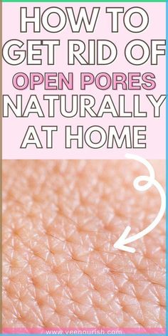 #opnepores#blackheads#beauty#beautytips#skincare How To Have Poreless Skin, How To Reduce Pores On Face, Large Pores On Face, Minimize Pores Naturally, Pores On Face, Face Remedies, Smooth Clear Skin, Pore Shrinking, Clear Skin Naturally