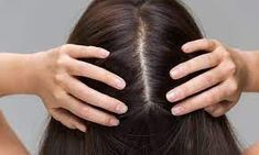 Here are 9 simple and science-backed ways to keep your scalp healthy. 
Because a hot mane starts with a healthy head! Scalp Scabs, Scaly Skin, Scalp Serum, Oily Scalp, Itchy Scalp, Healthy Scalp, Dry Scalp, Hair Regrowth, Strong Hair