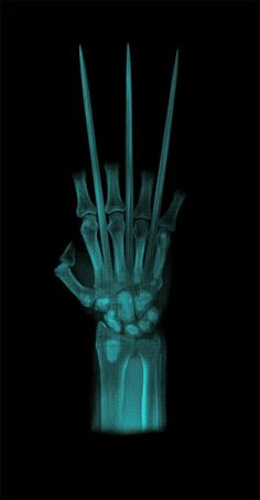 a x - ray image of a human hand holding something in it's palm