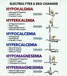 Electrolytes & EKG Changes #medicalschool #resources #medicalstudent - Image Credits: Christine Benedict Paramedic Motivation, Er Medicine, Paramedic Tips, Nursing Theories, Ekg Rhythms, Medical Assistant Student