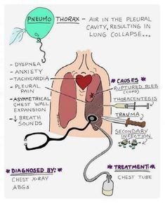 the diagram shows how to use an inflatable device for breathing and heart health