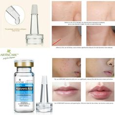 ARTISCARE Coenzyme Q10 Aging Hydraterende Olie-control Whitening Serum10ml Description relieves redness and shrinks pores 10ml Anti-aging,Anti-Wrinkle,Firming,Moisturises,Hydrates Also helps:Acne,Dark Circles,Wrinkles,Puffiness,Clearing impurities,Skin problems,Moisturising 2-3 drops will be ok,donnot use it too much.If you on mask,you can use more than 3 drops. Pat , until the liquid is completely absorbed by the skin When you donnot use it,just keep the small cover on the dripper.Please noted Serum For Dry Skin, Erase Wrinkles, Face Brightening, Coenzyme Q10, Receding Gums, Skin Redness, Anti Aging Facial, Anti Aging Face, Moisturizing Serum