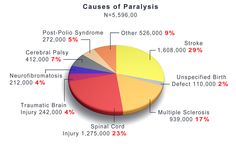 Image pie chart showing the different causes of paralysis. Spinal Cord, The Two, Back Pain, The Body, Pie Chart, Pie